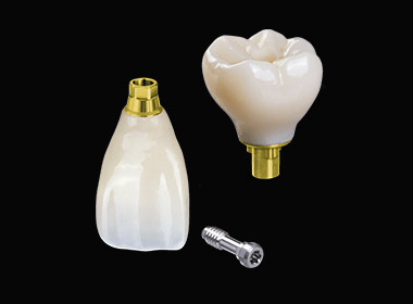 Implant Crown