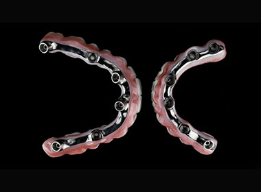 Implant Bar